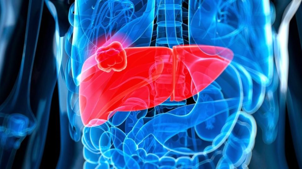 o-LIVER-CANCER-facebook